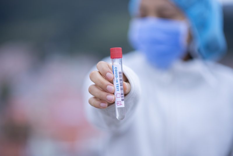 a person wearing a mask and holding a test tube